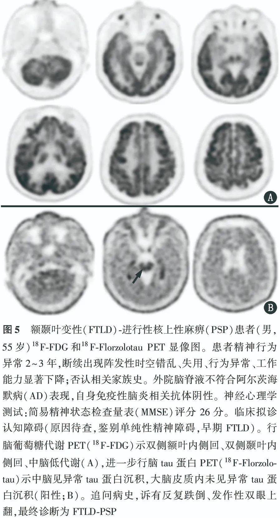 应用隐藏专家视频下载(应用隐藏大师怎样隐藏应用视频)下载